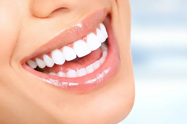 hollywood-smile-cost-in-turkey-2025